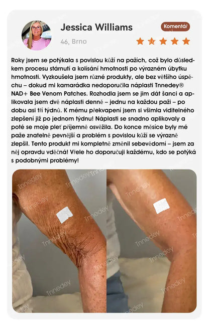 [Oficiální obchod] Tnnedey® NAD+ náplast s včelím jedem – Dokonalé omlazení pleti a příval energie (Poslední den slevy: 75 %)