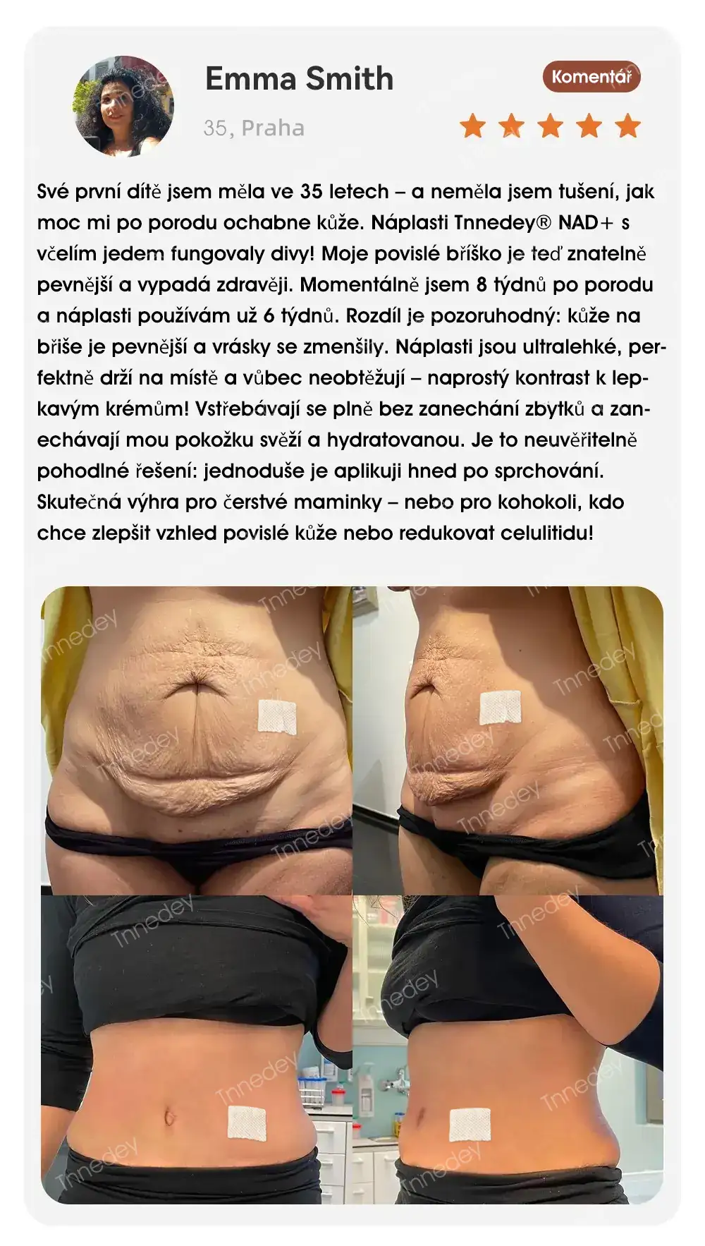 [Oficiální obchod] Tnnedey® NAD+ náplast s včelím jedem – Dokonalé omlazení pleti a příval energie (Poslední den slevy: 75 %)
